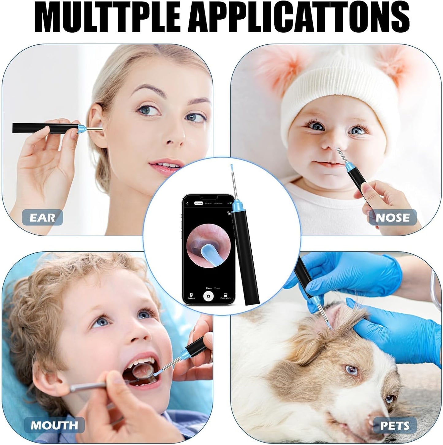 Earwax Remover Tool with 7 Pcs Set IOS/Android